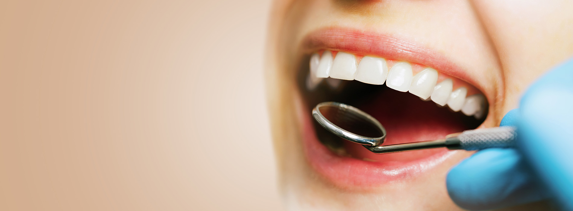 The image shows a close-up of a person s mouth with teeth being cleaned or prepared for dental treatment, with visible dental instruments and a blue glove.