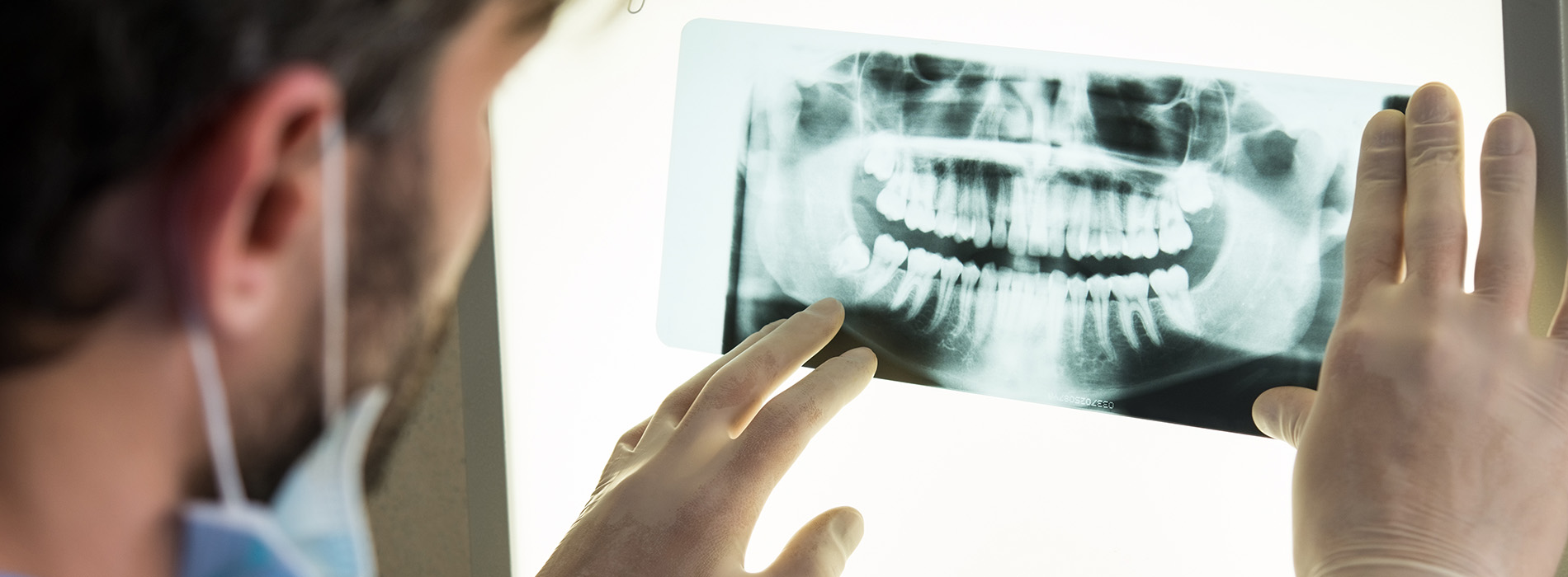 A dental professional examines a digital X-ray of a patient s teeth and mouth, with the screen displaying a clear image of the oral cavity.