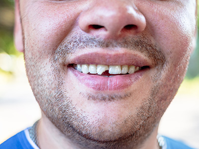 A smiling man with a beard and missing teeth, looking directly at the camera.